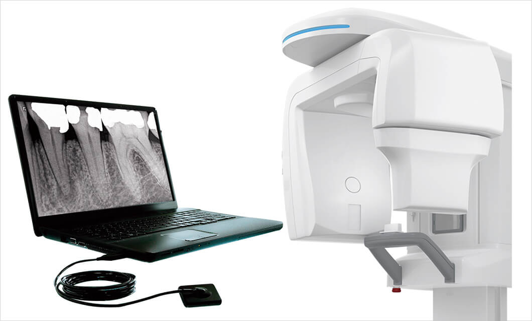 デジタルレントゲン